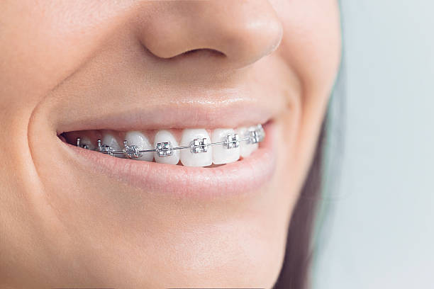 Why Choose Us for Your Dental Needs in Harbor Beach, MI